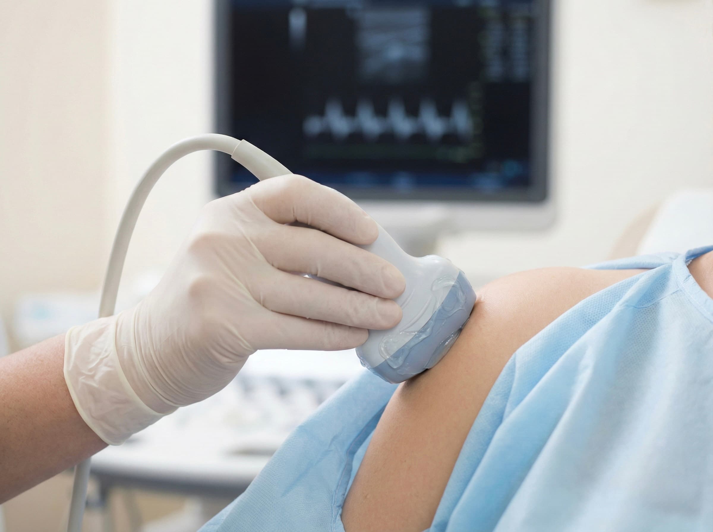 Sonographie
